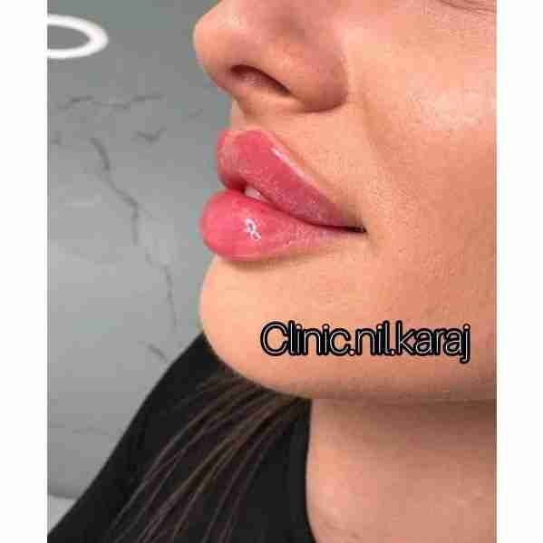 lips