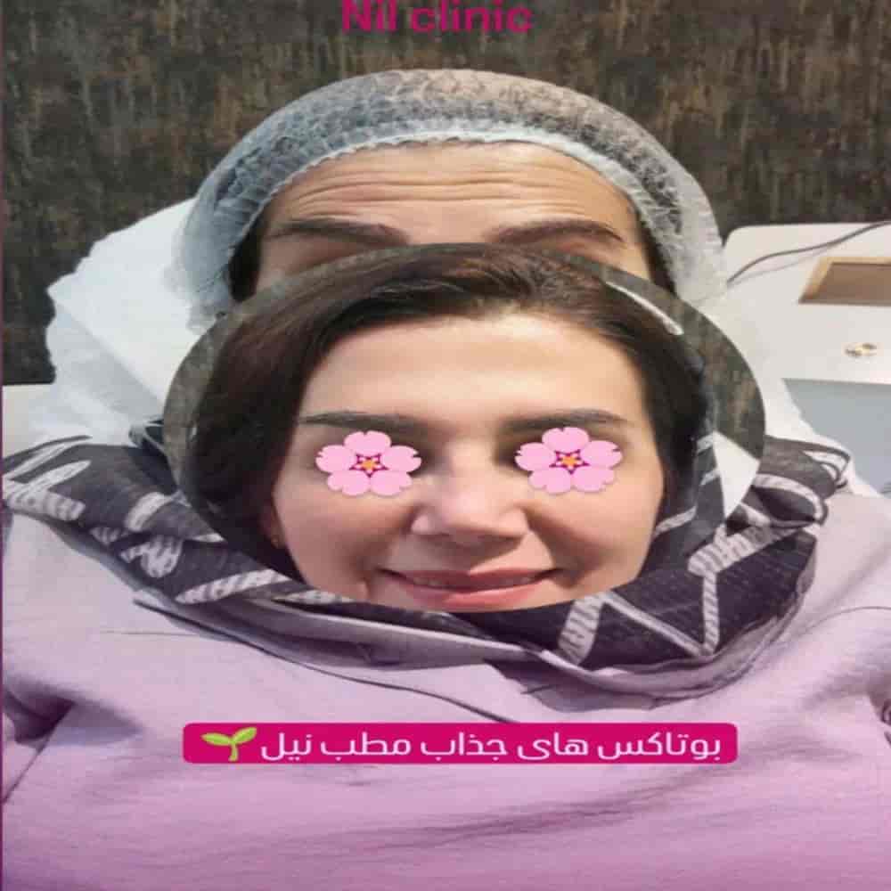 Çok güzel botoks Bayan Joy