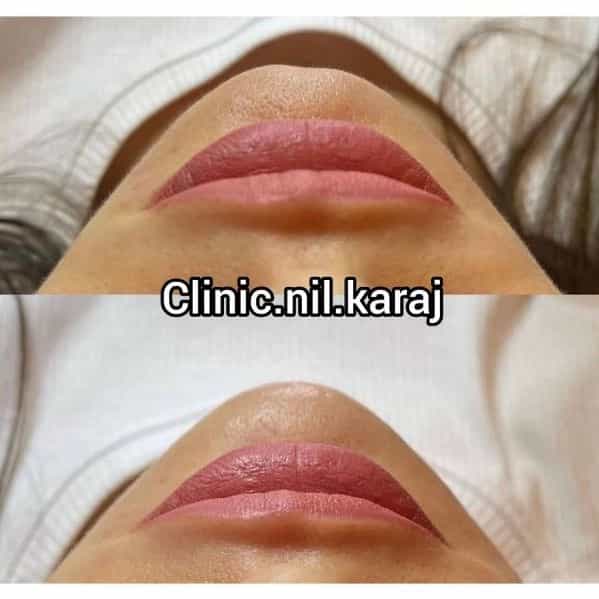 1710145374679.webp