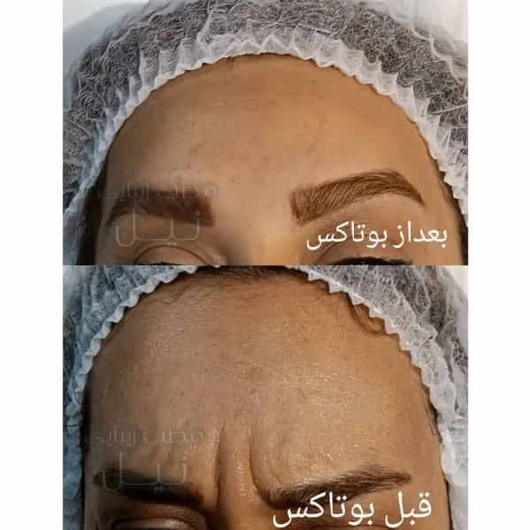 1710144654566.webp