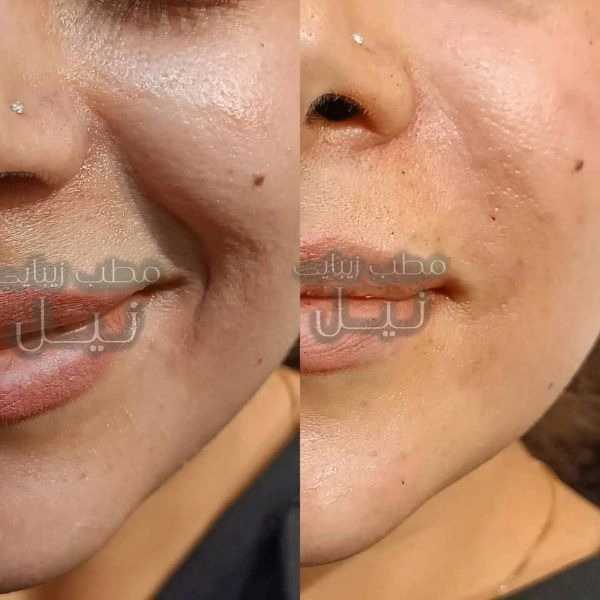 1709110089114.webp