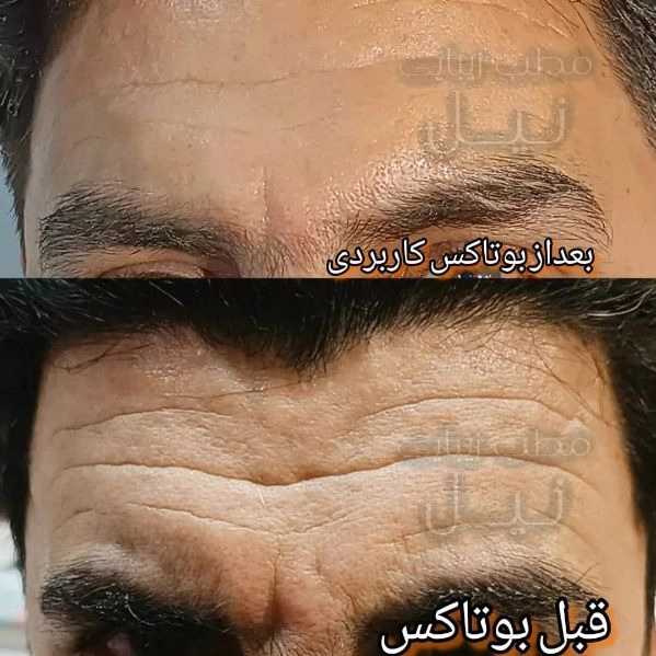 1710144963421.webp