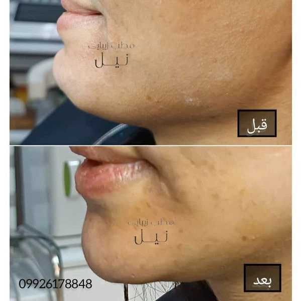 1710145265653.webp