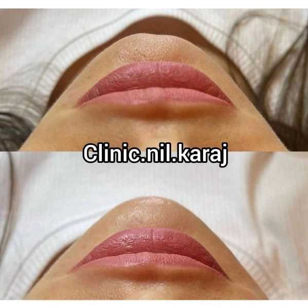 1710145374679.webp