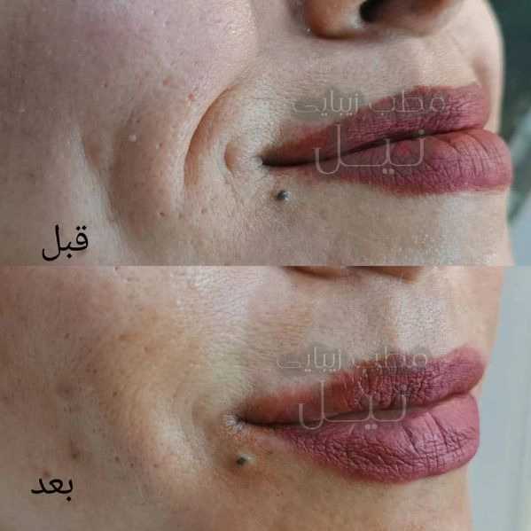 1710145413012.webp